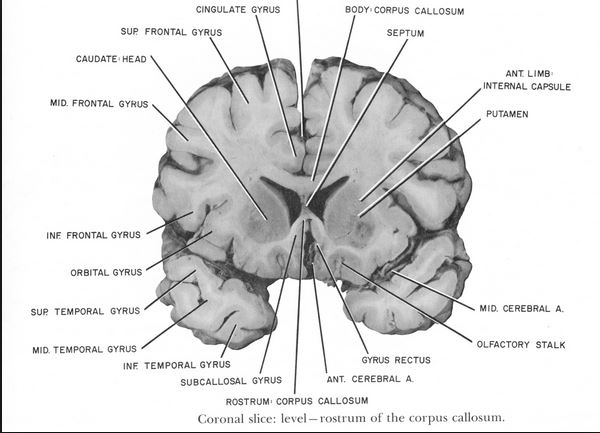 thalamus